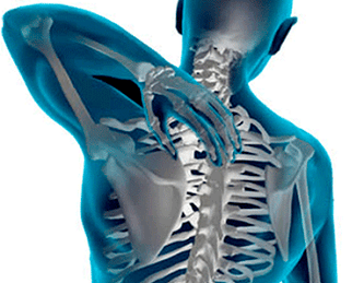 the manifestation of thoracic spine osteochondrosis